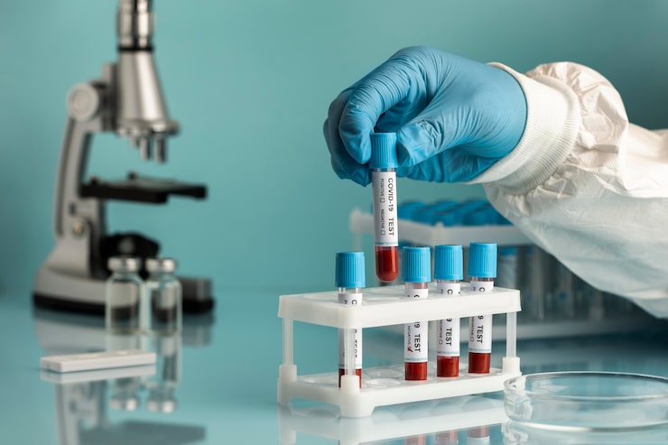 Nutrigenomics Test Measures